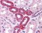 RPS6KB1 / P70S6K / S6K Antibody (C-Terminus)